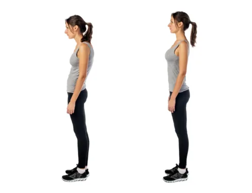 Patient corrected her body posture with NeuroFT tips