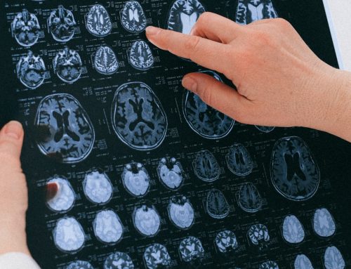 Rehabilitación Neurológica en el manejo de las Secuelas posterior a un Ictus Cerebral